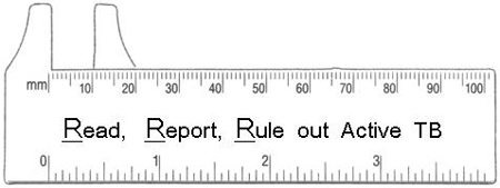 Tb Skin Test Ruler Printable